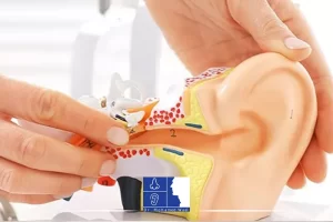 افضل دكتور سمعيات فى مصر