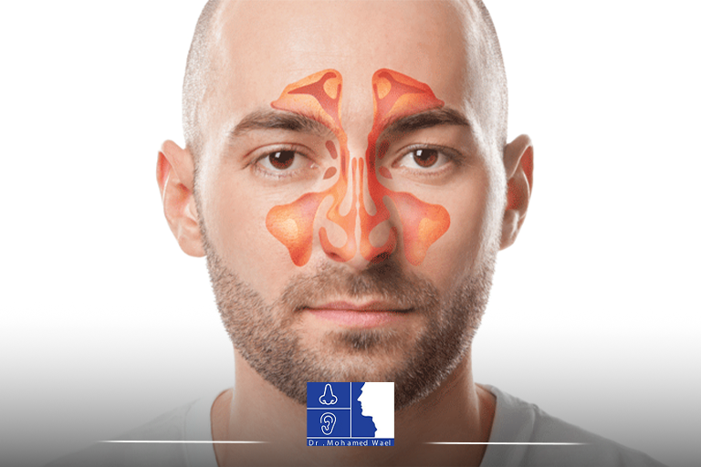 ما هي الجيوب الانفية